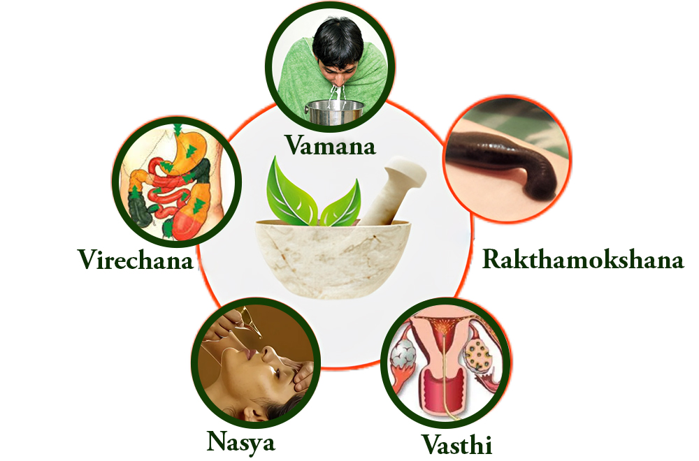 Master Diploma in Pancha Karma (M.D.P.K.)