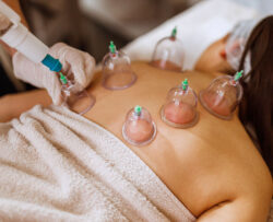 a image with performed dry cupping on back
