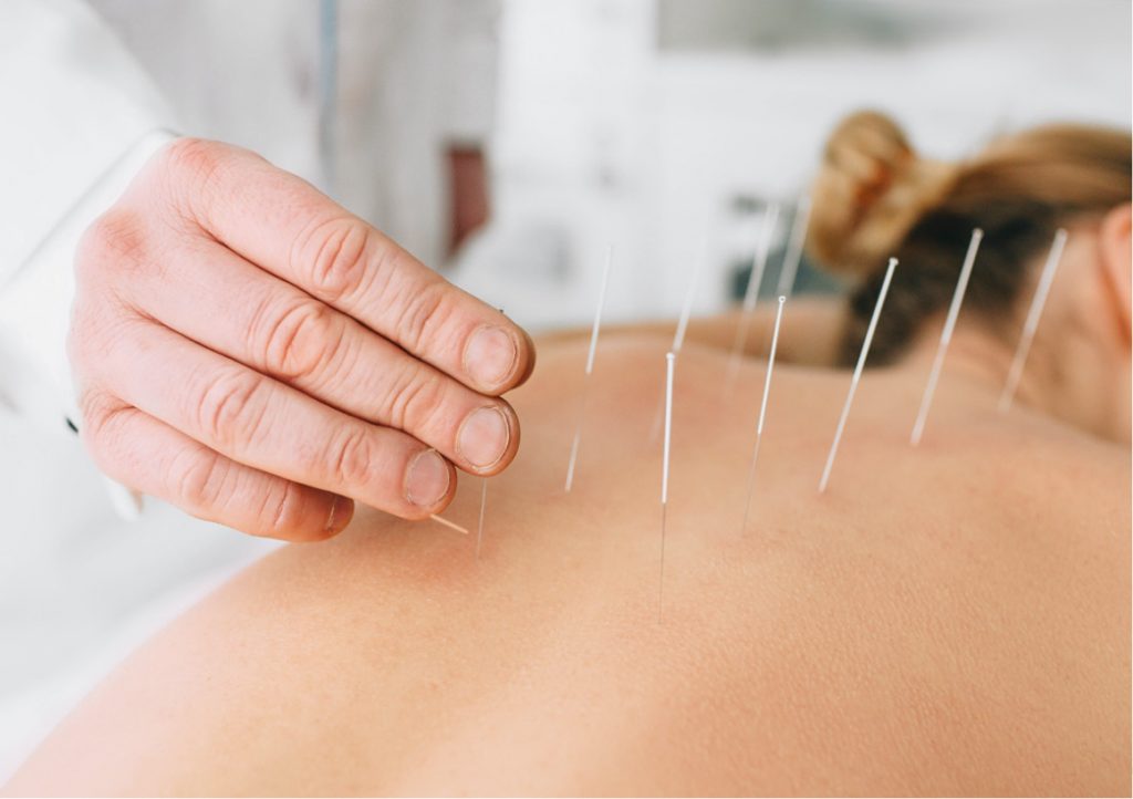 Master Diploma in Dry Needling (M.D.Dr.N)