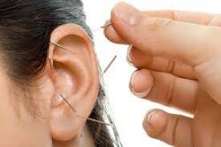a image with auricular reflex zone