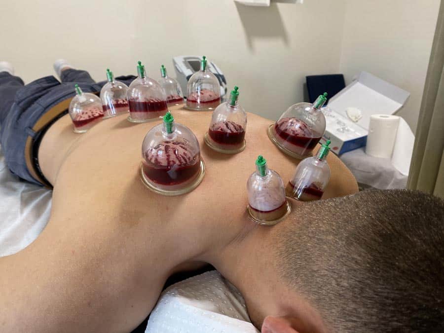 Diploma in Hijama Therapy (D.H.T.)