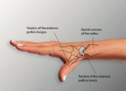 course-image