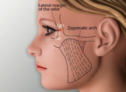 course-image